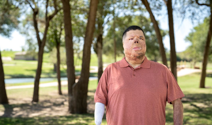 El veterano herido Anthony Villareal parado al aire libre.